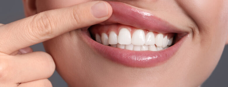 Gum Graft