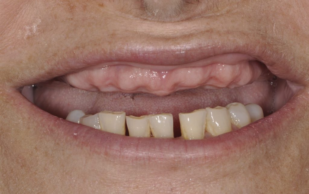 Before photo of a patient smile from our practice
