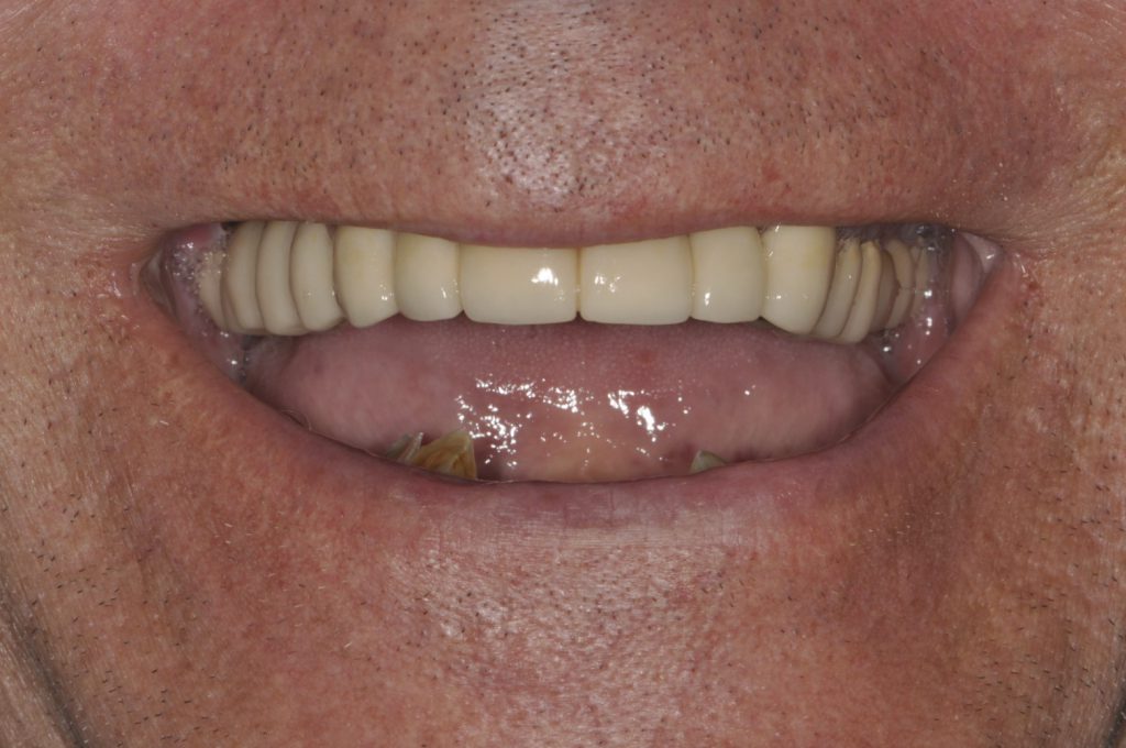 Before photo of a patient smile from our practice