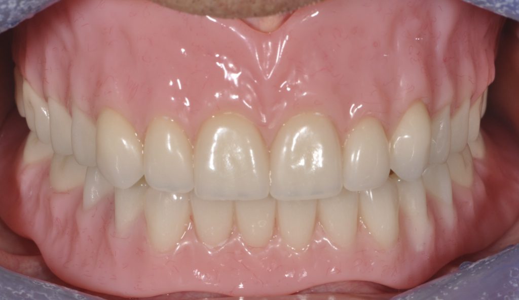 After photo of a patient smile from our practice