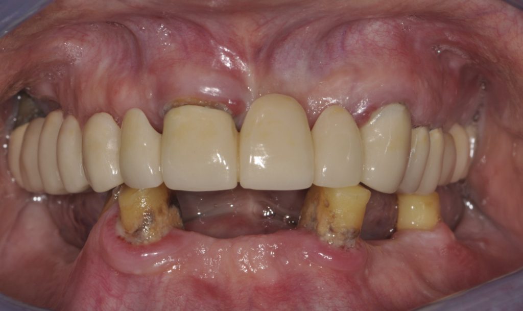 Before photo of a patient smile from our practice