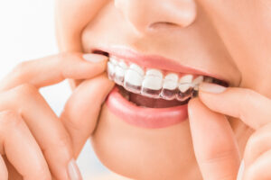 white teeth